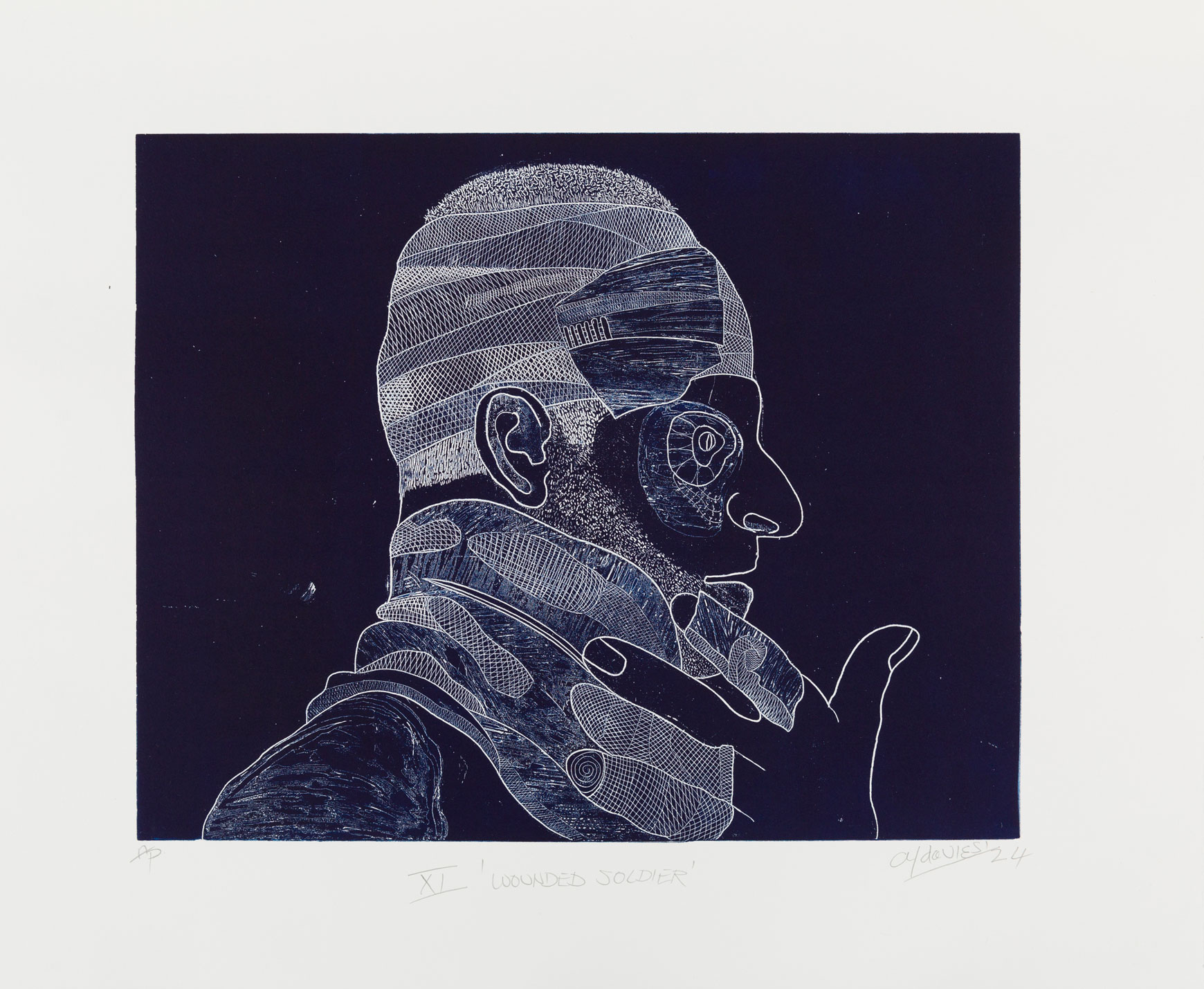 Printmaking image of an intricately etched wounded soldier on a dark blue background